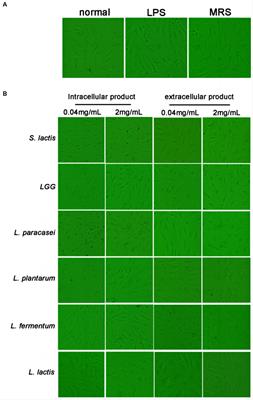 The preventative effects of Lactococcus Lactis metabolites against LPS-induced sepsis